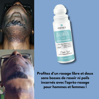Pansly™  Sérum après-rasage